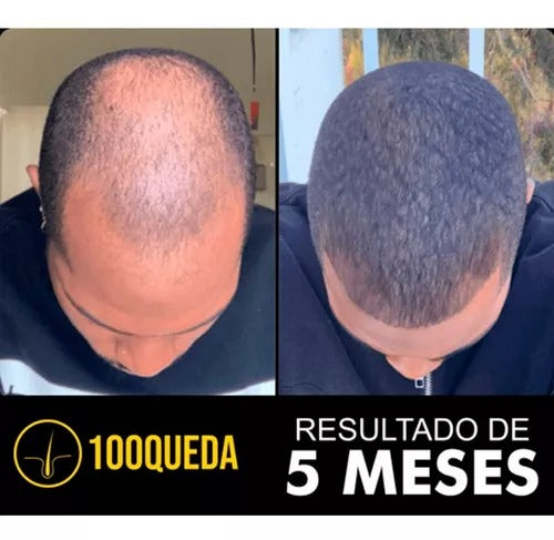 100Queda - Compre 1 Leve 2 -