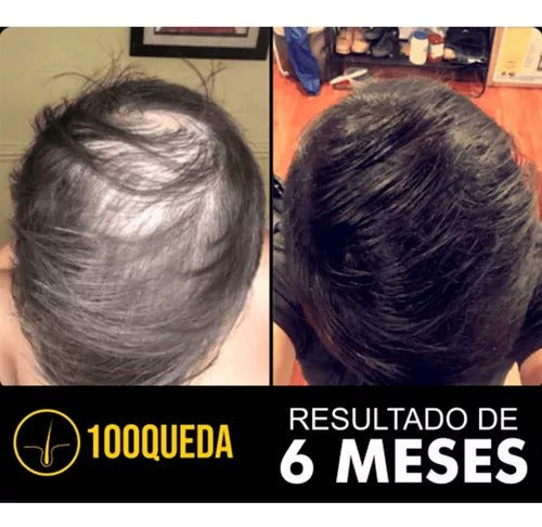 100Queda - Compre 1 Leve 2 -