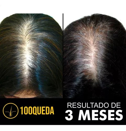 100Queda - Compre 1 Leve 2 -