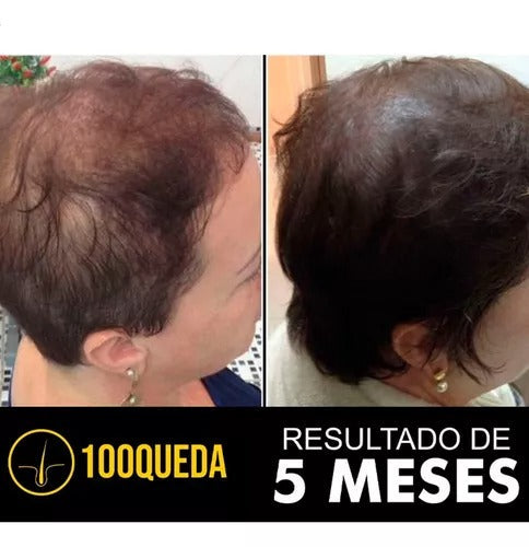 100Queda - Compre 1 Leve 2 -