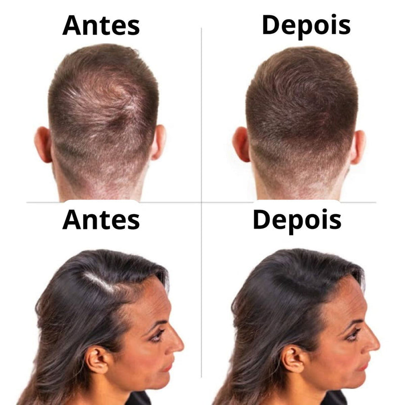 BOLDIFY Hairline Powder - Pó Para Cabelo - Compre 1 Leve 2