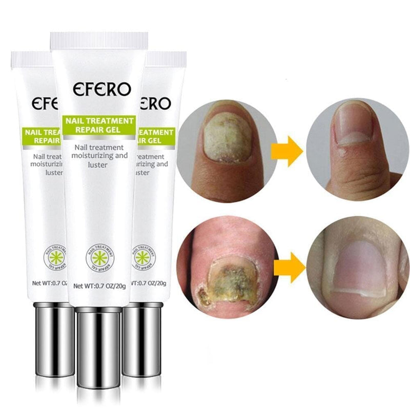 Efero Nails Compre 1 Leve 2 - Gel Anti Fungos e Micoses de Unhas