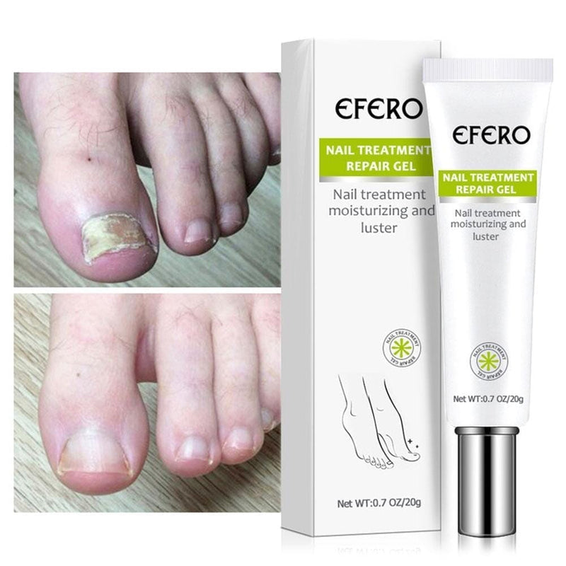 Efero Nails Compre 1 Leve 2 - Gel Anti Fungos e Micoses de Unhas