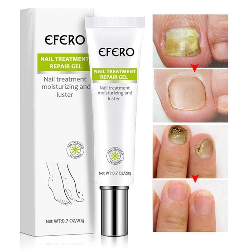 Efero Nails Compre 1 Leve 2 - Gel Anti Fungos e Micoses de Unhas