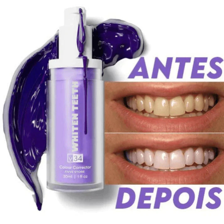 Clareador Dental Whiten Teeth + Brinde - Site Oficial De Vendas