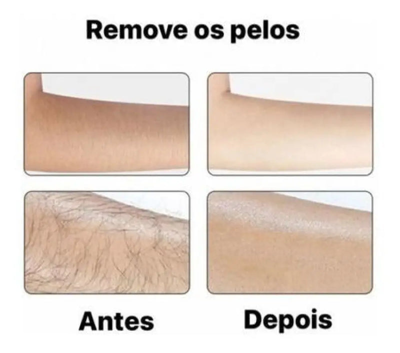 Clareador e Inibidor de Pelos Labotrat Dermo Skin + Frete Grátis