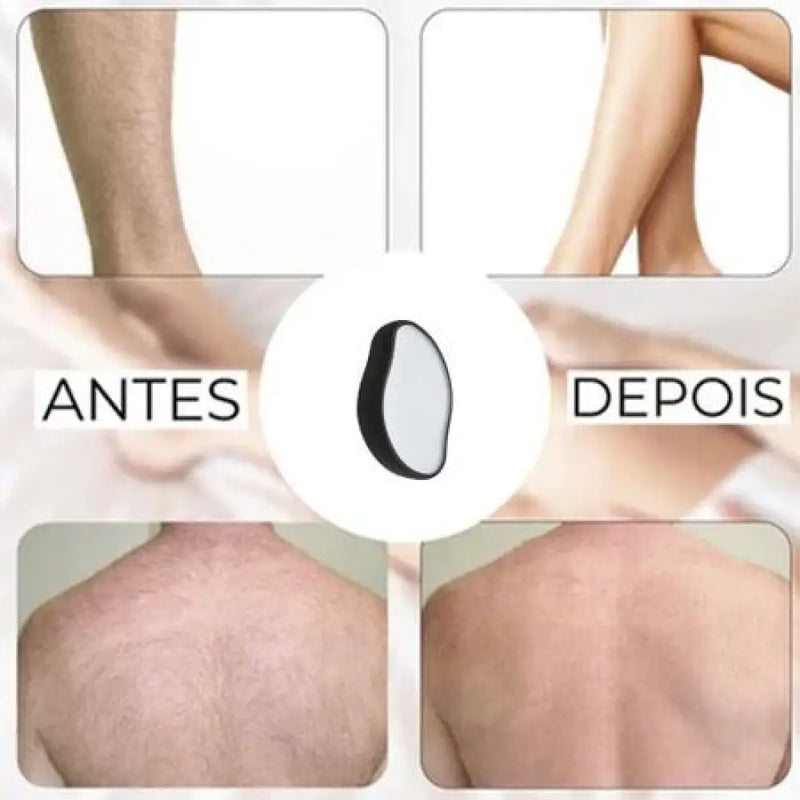 Clareador e Inibidor de Pelos Labotrat Dermo Skin + Frete Grátis