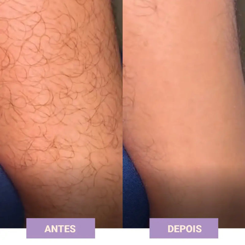 Clareador e Inibidor de Pelos Labotrat Dermo Skin + Frete Grátis