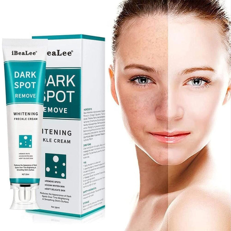 Compre 1 Leve 2 - Creme Clareador Para Remover Melasma - Dark Spot + Brinde - Oferta Somente Hoje