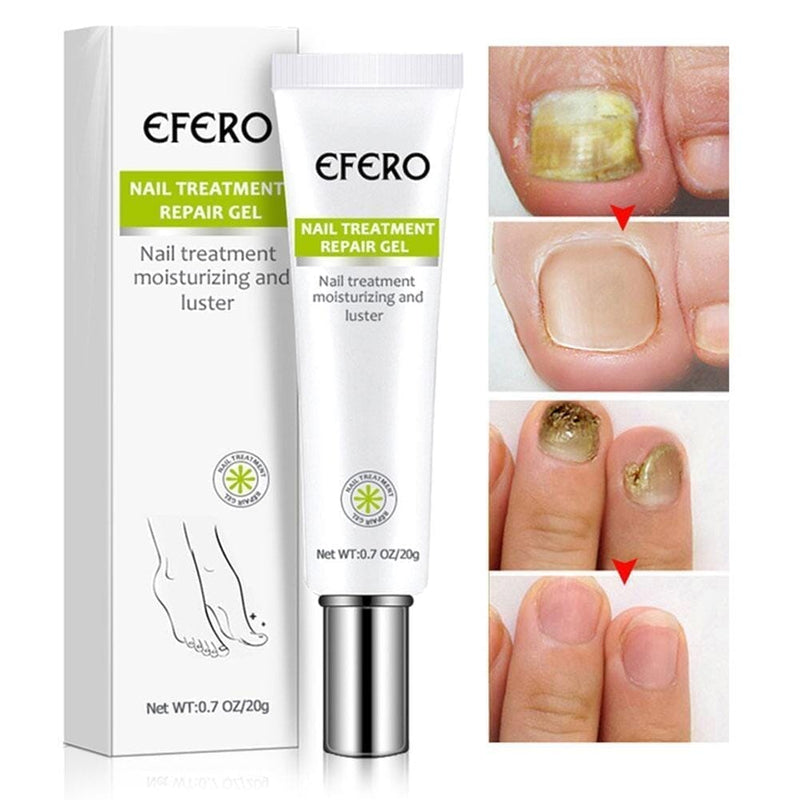 Compre 1 Leve 3 - Efero Nails - Gel Anti Fungos e Micoses - Oferta Somente Hoje