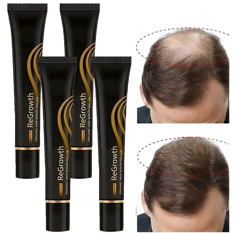 Compre 1 Leve 4 - Repair Hair Regrowth® Óleo de Crescimento Capilar + Brinde - Site Oficial De Vendas