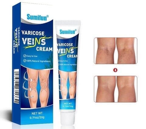 Compre 2 Leve 4 - Creme Para Varizes - Varicose Care Max