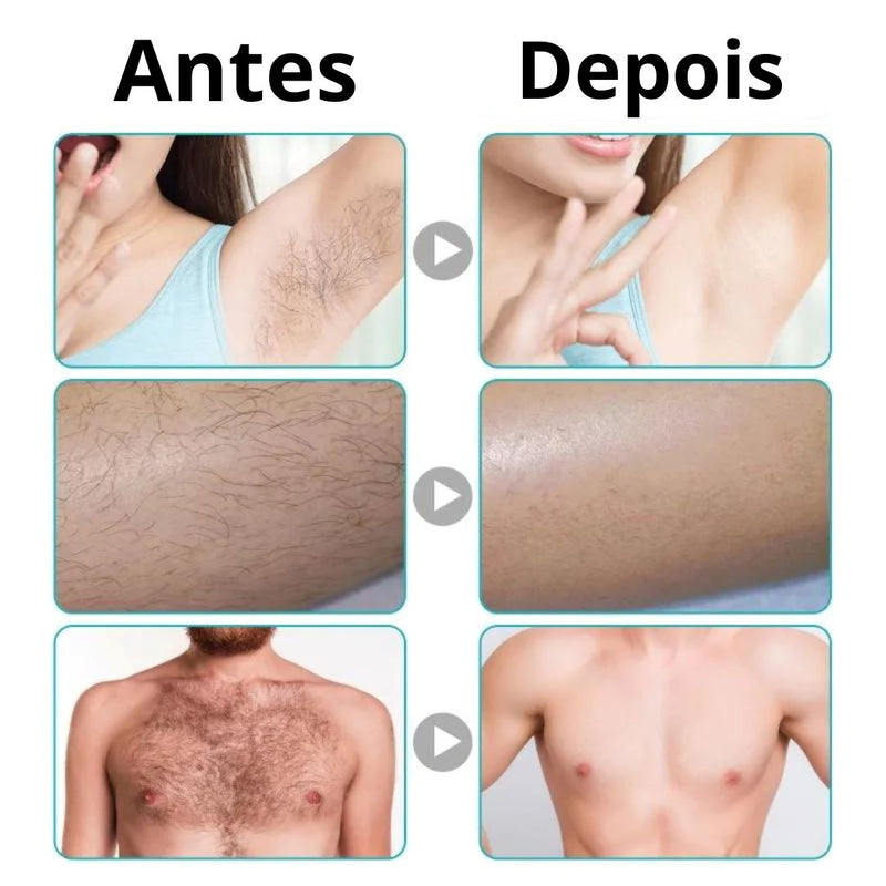 Creme Depilatório Para Partes Íntimas Cream Hair Removal + Brinde - Frete Grátis