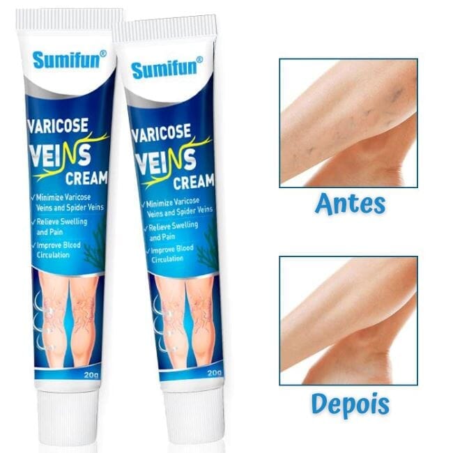 Creme Para Varizes Varicose Veins Cream + Brinde - Site Oficial De Vendas