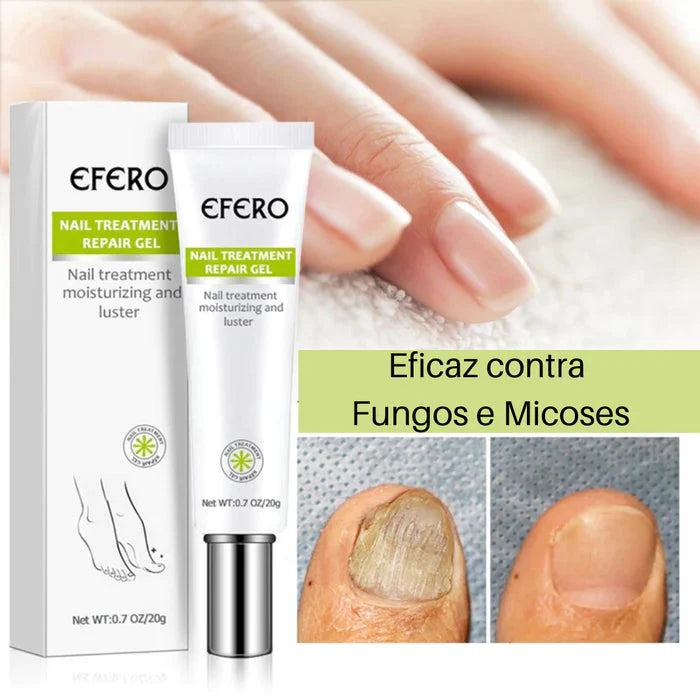 Efero Nails® - Gel Anti Fungos e Micoses - Site Oficial De Vendas