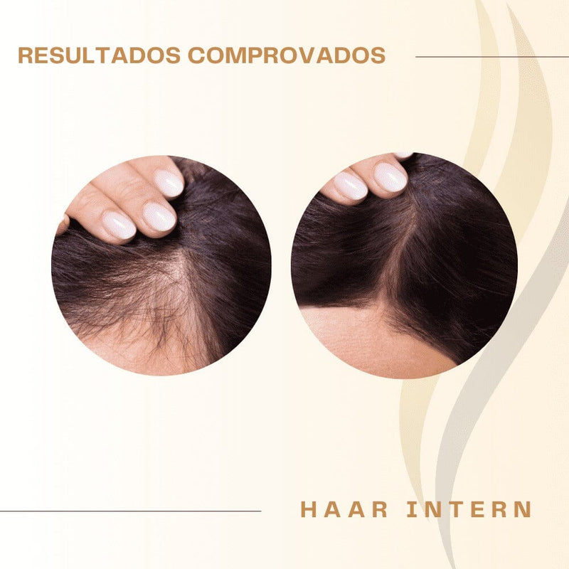 Haar Intern - Compre 1 Leve 2 - Cabelos Fortes e Saudáveis