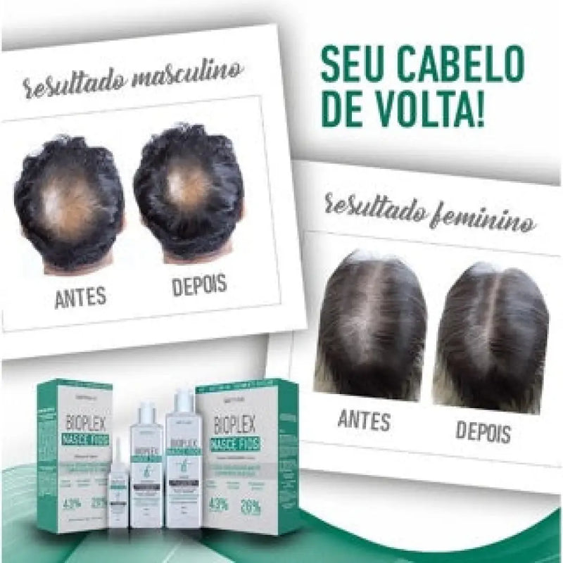 Kit Bioplex Nasce Fios e Antiqueda Tratamento Capilar (Shampoo, Condicionador e Tônico)