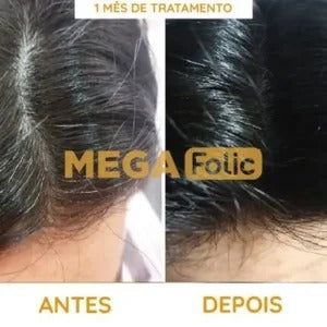 Mega Folic Compre 1 Leve 2 - Diga Adeus Ao Cabelo Branco