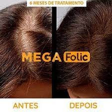 Mega Folic Compre 1 Leve 2 - Diga Adeus Ao Cabelo Branco