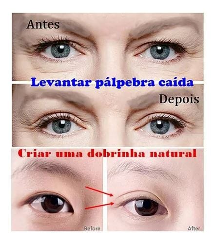 Palp Lifting Levanta Pálpebras Caídas + Brinde - Oferta Somente Hoje