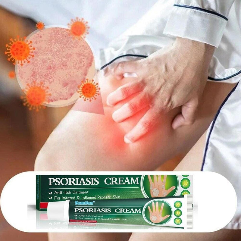 Pomada Para Psoríase Instantânea - Psoriasis Cream + Brinde - Oferta Somente Hoje