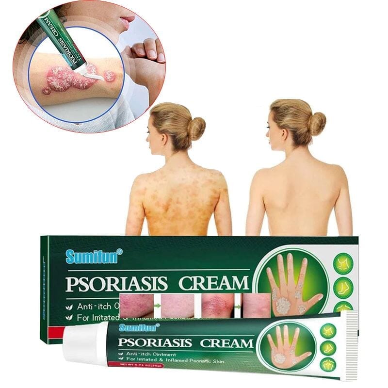 Pomada Para Psoríase Instantânea - Psoriasis Cream + Brinde - Oferta Somente Hoje