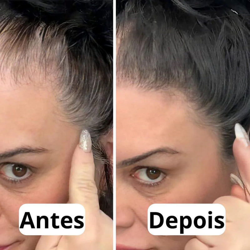 Promoção Compre 1 Leve 2 - Boldify Hairline Powder - Pó Para Cabelo