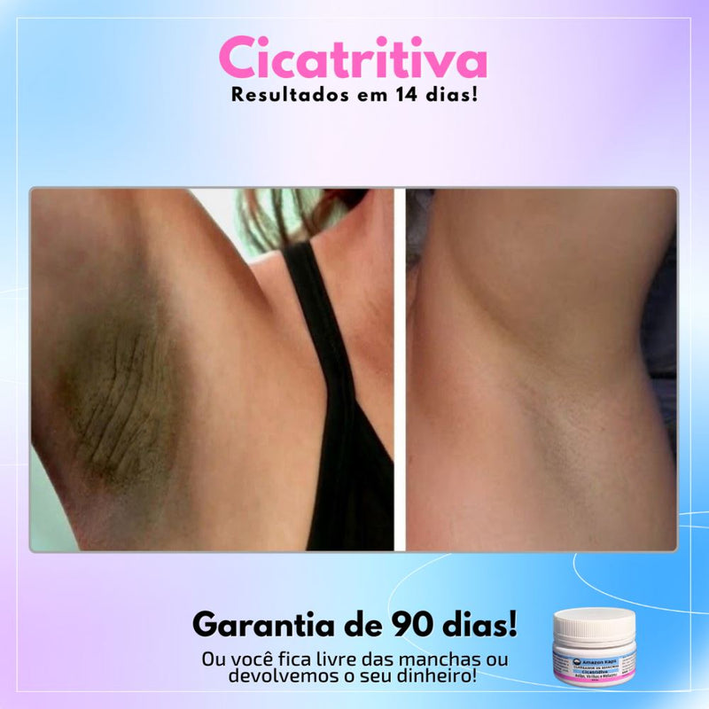 Promoção Compre 1 Leve 2 - Cicatridiva - Clareador de Manchas: Sua Jornada para uma Pele sem manchas