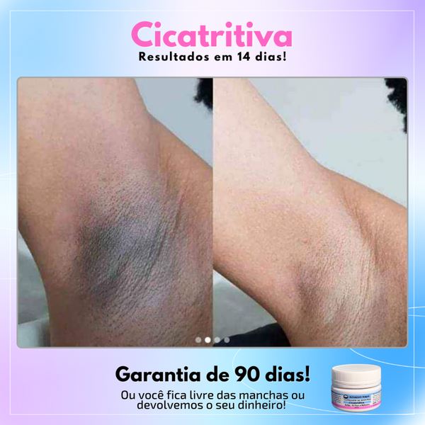 Promoção Compre 1 Leve 2 - Cicatridiva - Clareador de Manchas: Sua Jornada para uma Pele sem manchas