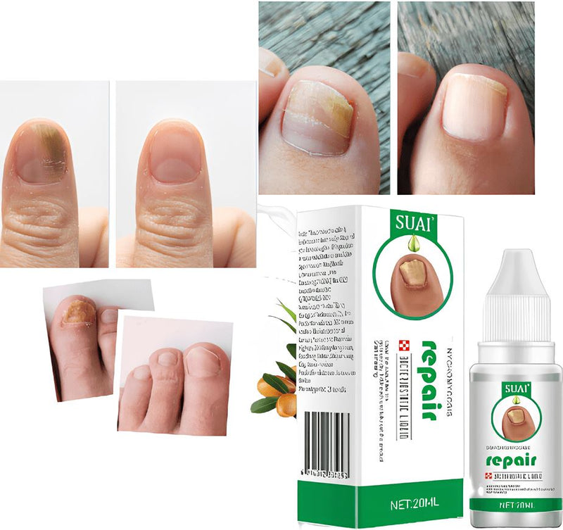 Promoção Compre 1 Leve 3 - Suai Repair - Elimina Fungos e Restaura Unhas Danificadas