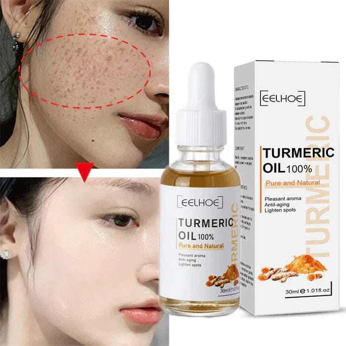 Promoção Compre 1 Leve 3 - Turmeric Óleo Anti-Idade Removedor de Manchas - Frete Grátis