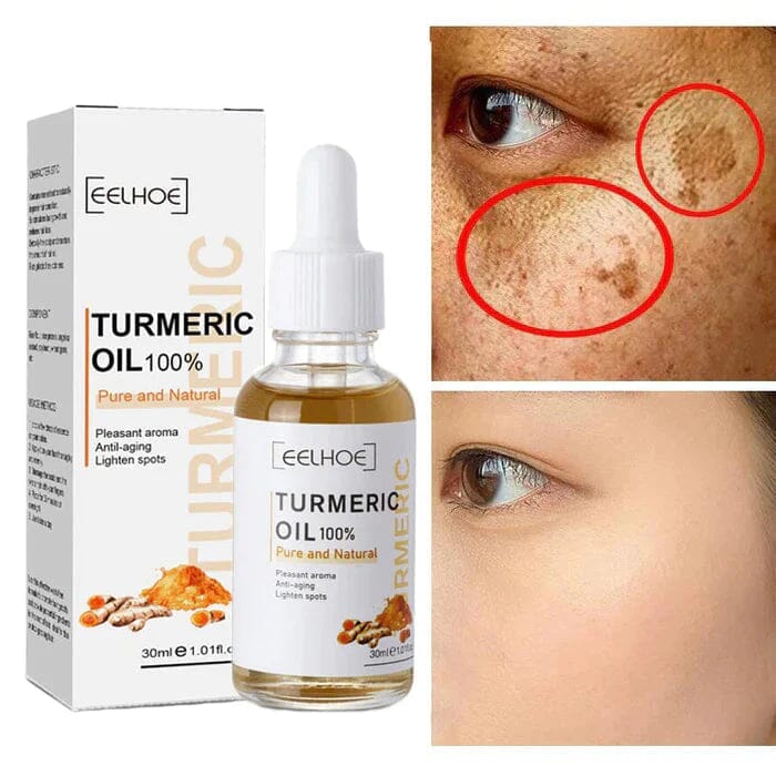 Promoção Compre 1 Leve 3 - Turmeric Óleo Anti-Idade Removedor de Manchas - Frete Grátis