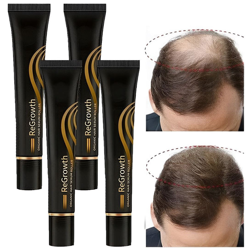 Repair Hair Regrowth® Óleo de Crescimento Capilar + Brinde - Site Oficial De Vendas