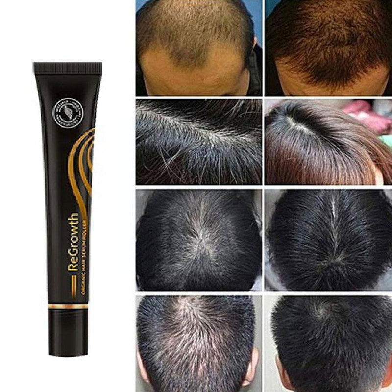 Repair Hair® Óleo de Crescimento Capilar + Brinde - Site Oficial De Vendas