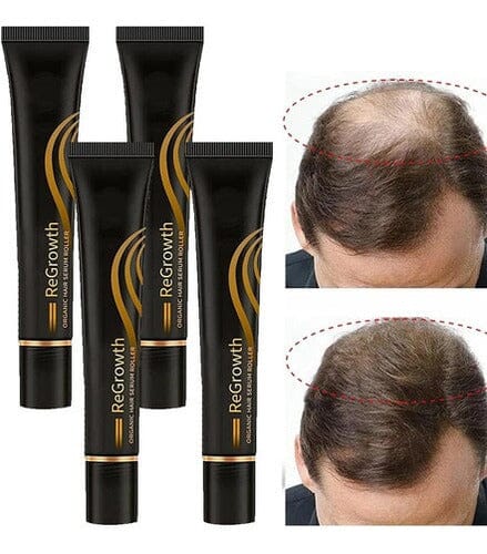 Repair Hair® Óleo de Crescimento Capilar + Brinde - Site Oficial De Vendas