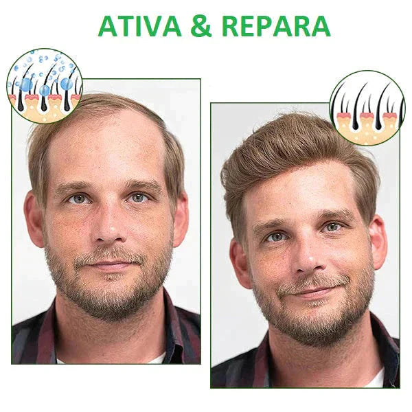 Compre 1 Leve 2 -Kortin Hair Crescimento Capilar 20x Mais Rápido