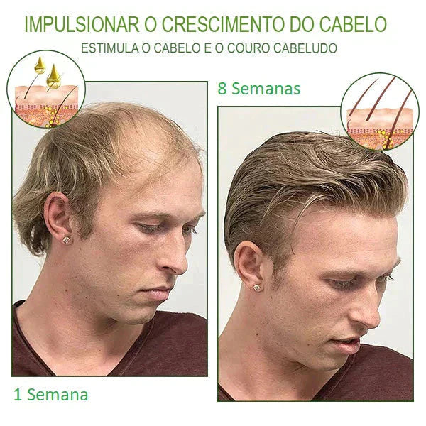 Compre 1 Leve 2 -Kortin Hair Crescimento Capilar 20x Mais Rápido