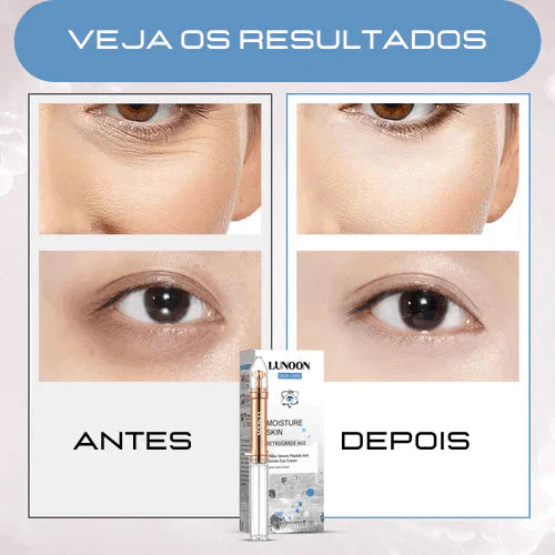 VisionSkin™ 3D - Revitaliza Os Olhos 6 Em 1 (COMPRE 3 LEVE 5) + Brinde - Site Oficial De Vendas